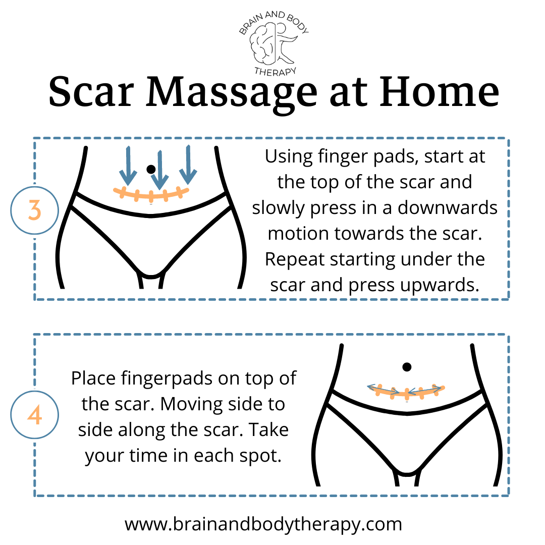 Scar tissue massage